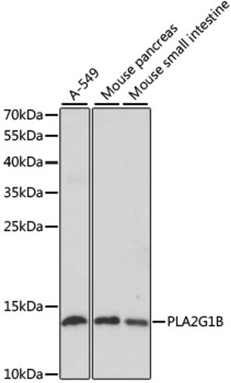 Western blot analysis of extracts of various cell lines, using PLA2G1B antibody (19-688) at 1:1000 dilution.<br/>Secondary antibody: HRP Goat Anti-Rabbit IgG (H+L) at 1:10000 dilution.<br/>Lysates/proteins: 25ug per lane.<br/>Blocking buffer: 3% nonfat dry milk in TBST.<br/>Detection: ECL Enhanced Kit.<br/>Exposure time: 90s.