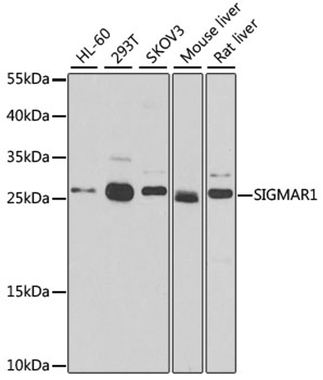 Western blot analysis of extracts of various cell lines, using SIGMAR1 antibody (19-689) at 1:500 dilution.<br/>Secondary antibody: HRP Goat Anti-Rabbit IgG (H+L) at 1:10000 dilution.<br/>Lysates/proteins: 25ug per lane.<br/>Blocking buffer: 3% nonfat dry milk in TBST.<br/>Detection: ECL Basic Kit.<br/>Exposure time: 90s.