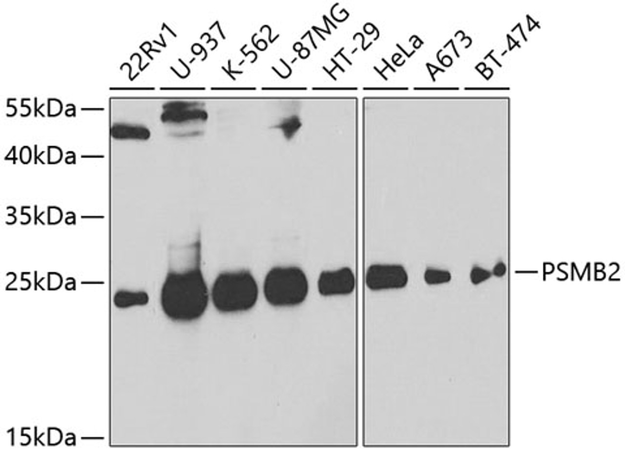 Western blot analysis of extracts of various cell lines, using PSMB2 antibody (19-692) at 1:1000 dilution._Secondary antibody: HRP Goat Anti-Rabbit IgG (H+L) at 1:10000 dilution._Lysates/proteins: 25ug per lane._Blocking buffer: 3% nonfat dry milk in TBST._Detection: ECL Basic Kit._Exposure time: 90s.