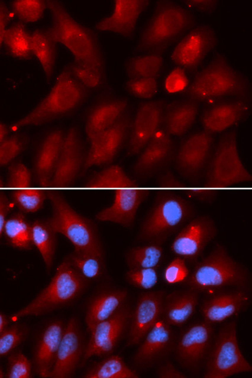 Immunofluorescence analysis of U2OS cells using PSMB2 antibody (19-692) . Blue: DAPI for nuclear staining.
