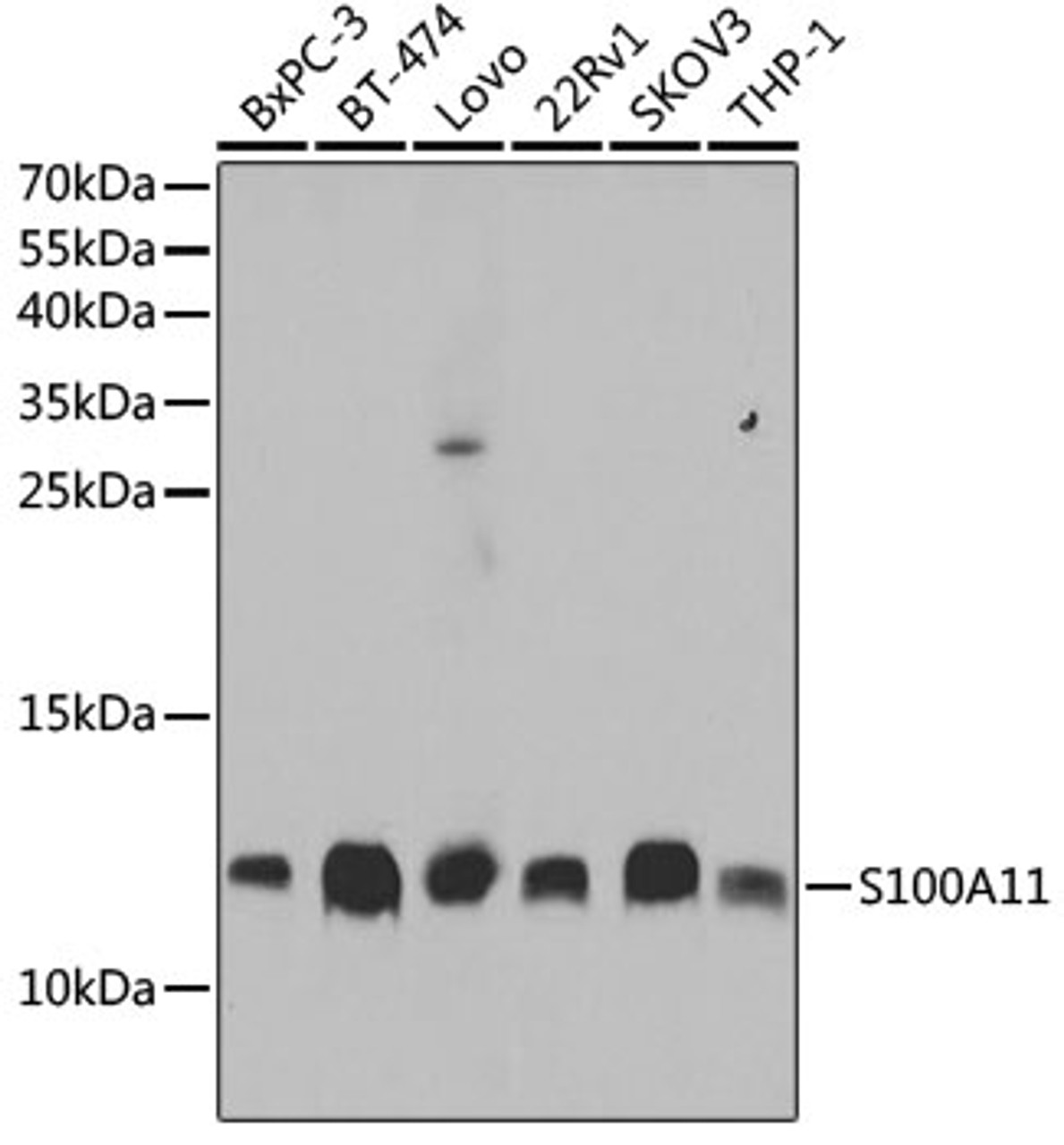 Western blot analysis of extracts of various cell lines, using S100A11 antibody (19-695) at 1:1000 dilution.<br/>Secondary antibody: HRP Goat Anti-Rabbit IgG (H+L) at 1:10000 dilution.<br/>Lysates/proteins: 25ug per lane.<br/>Blocking buffer: 3% nonfat dry milk in TBST.<br/>Detection: ECL Basic Kit.<br/>Exposure time: 10s.