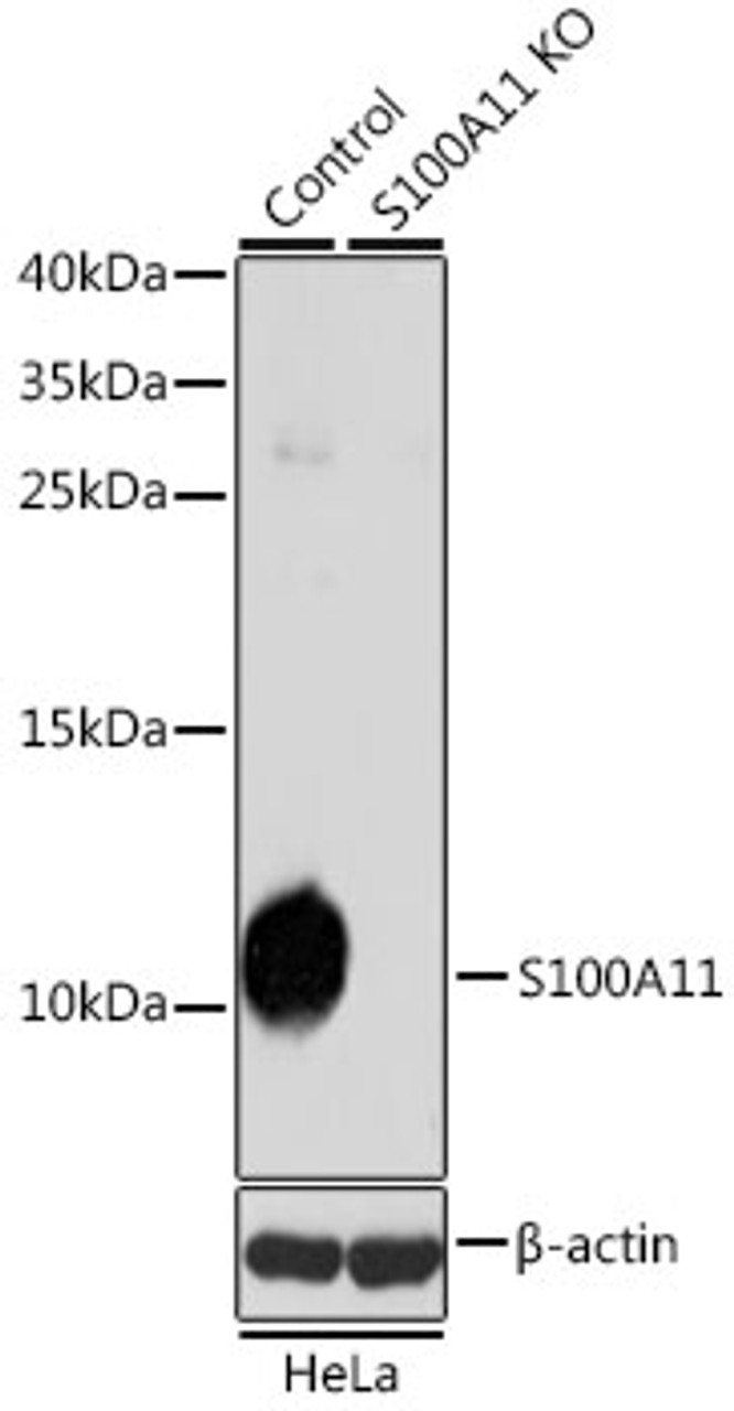 Western blot analysis of extracts from normal (control) and S100A11 knockout (KO) HeLa cells, using S100A11 antibody (19-695) at 1:1000 dilution.<br/>Secondary antibody: HRP Goat Anti-Rabbit IgG (H+L) at 1:10000 dilution.<br/>Lysates/proteins: 25ug per lane.<br/>Blocking buffer: 3% nonfat dry milk in TBST.<br/>Detection: ECL Basic Kit.<br/>Exposure time: 10s.