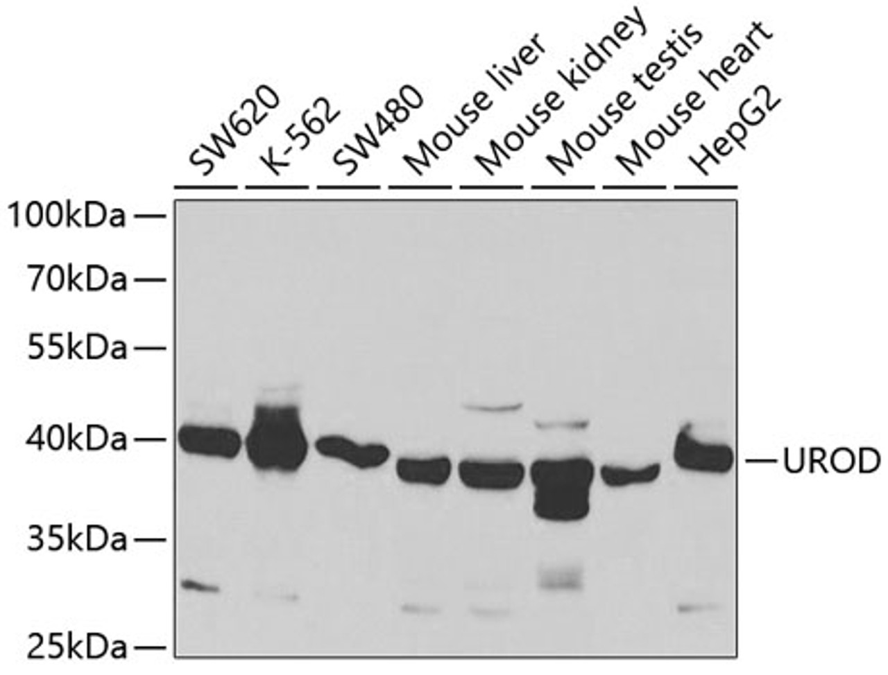 Western blot analysis of extracts of various cell lines, using UROD antibody (19-699) at 1:1000 dilution.<br/>Secondary antibody: HRP Goat Anti-Rabbit IgG (H+L) at 1:10000 dilution.<br/>Lysates/proteins: 25ug per lane.<br/>Blocking buffer: 3% nonfat dry milk in TBST.<br/>Detection: ECL Basic Kit.<br/>Exposure time: 5s.