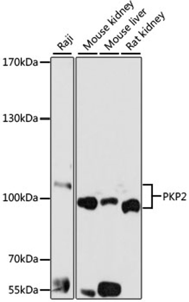 Western blot analysis of extracts of various cell lines, using PKP2 antibody (19-705) at 1:1000 dilution.<br/>Secondary antibody: HRP Goat Anti-Rabbit IgG (H+L) at 1:10000 dilution.<br/>Lysates/proteins: 25ug per lane.<br/>Blocking buffer: 3% nonfat dry milk in TBST.<br/>Detection: ECL Basic Kit.<br/>Exposure time: 10s.