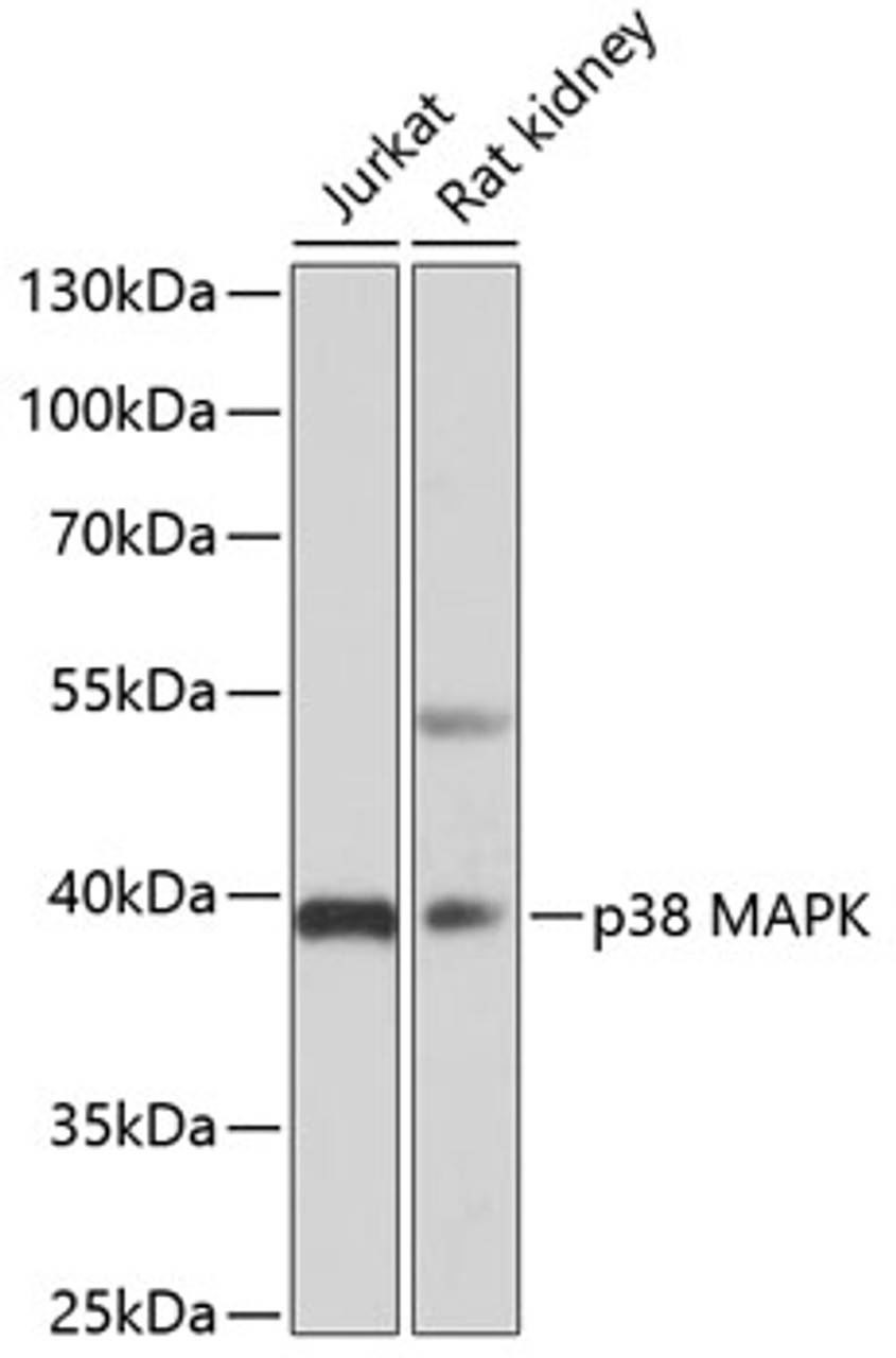 Western blot analysis of extracts of various cell lines, using p38 MAPK antibody (19-708) at 1:3000 dilution.<br/>Secondary antibody: HRP Goat Anti-Rabbit IgG (H+L) at 1:10000 dilution.<br/>Lysates/proteins: 25ug per lane.<br/>Blocking buffer: 3% nonfat dry milk in TBST.<br/>Detection: ECL Basic Kit.<br/>Exposure time: 40s.