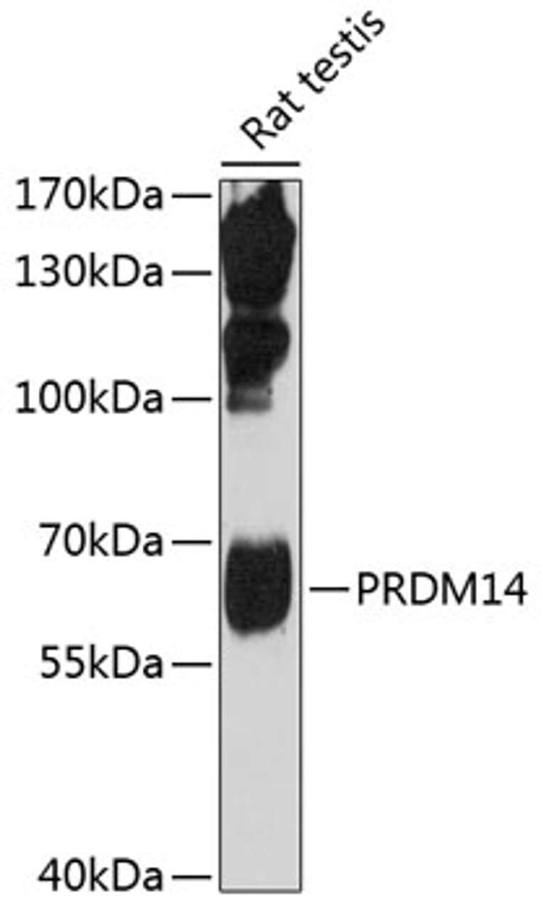 Western blot analysis of extracts of rat testis, using PRDM14 antibody (19-719) at 1:1000 dilution.<br/>Secondary antibody: HRP Goat Anti-Rabbit IgG (H+L) at 1:10000 dilution.<br/>Lysates/proteins: 25ug per lane.<br/>Blocking buffer: 3% nonfat dry milk in TBST.<br/>Detection: ECL Enhanced Kit.<br/>Exposure time: 90s.