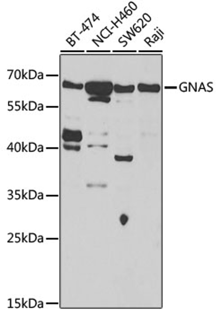 Western blot analysis of extracts of various cell lines, using GNAS antibody (19-722) at 1:1000 dilution.<br/>Secondary antibody: HRP Goat Anti-Rabbit IgG (H+L) at 1:10000 dilution.<br/>Lysates/proteins: 25ug per lane.<br/>Blocking buffer: 3% nonfat dry milk in TBST.<br/>Detection: ECL Basic Kit.<br/>Exposure time: 30s.