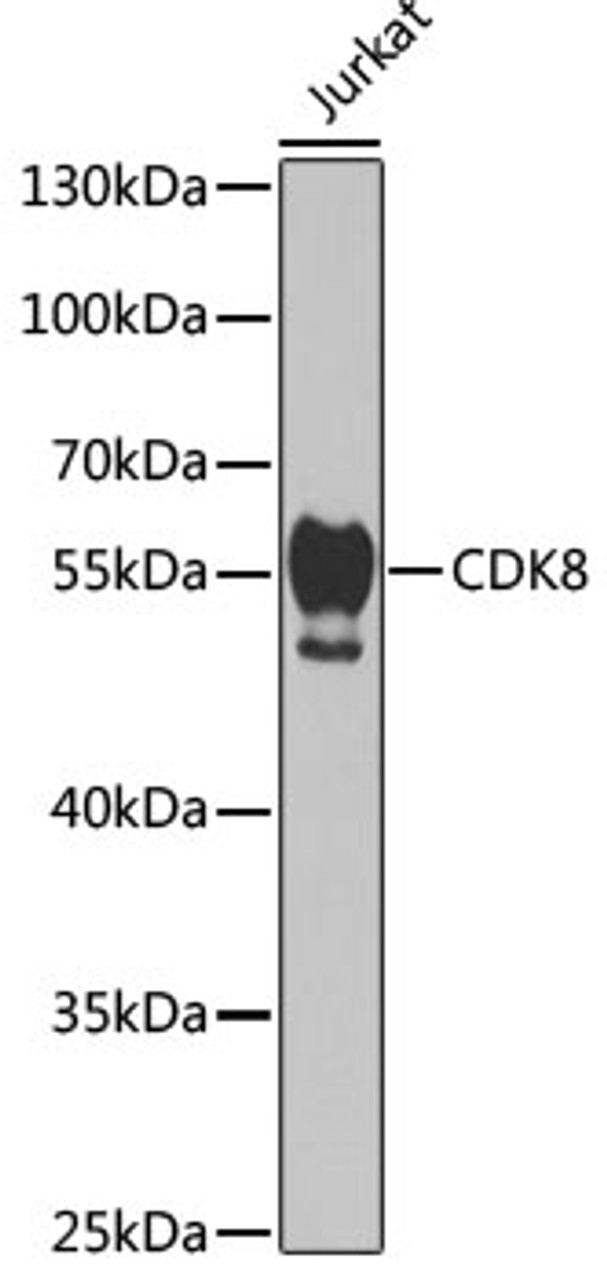 Western blot analysis of extracts of Jurkat cells, using CDK8 antibody (19-724) at 1:1000 dilution.<br/>Secondary antibody: HRP Goat Anti-Rabbit IgG (H+L) at 1:10000 dilution.<br/>Lysates/proteins: 25ug per lane.<br/>Blocking buffer: 3% nonfat dry milk in TBST.<br/>Detection: ECL Basic Kit.<br/>Exposure time: 90s.