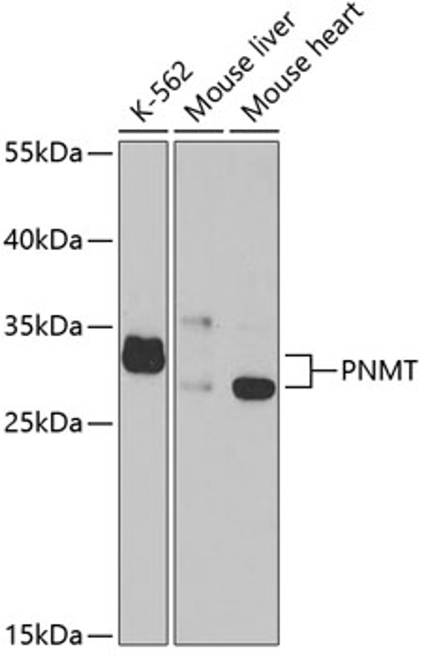 Western blot analysis of extracts of various cell lines, using PNMT antibody (19-727) at 1:1000 dilution.<br/>Secondary antibody: HRP Goat Anti-Rabbit IgG (H+L) at 1:10000 dilution.<br/>Lysates/proteins: 25ug per lane.<br/>Blocking buffer: 3% nonfat dry milk in TBST.<br/>Detection: ECL Basic Kit.<br/>Exposure time: 90s.