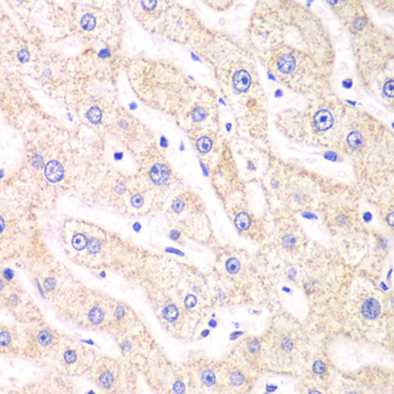 Immunohistochemistry of paraffin-embedded human liver damage using PSMF1 antibody (19-728) at dilution of 1:100 (40x lens) .