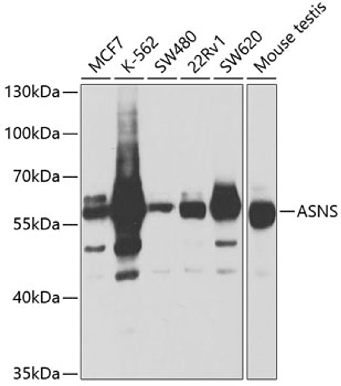 Western blot analysis of extracts of various cell lines, using ASNS antibody (19-731) at 1:1000 dilution.<br/>Secondary antibody: HRP Goat Anti-Rabbit IgG (H+L) at 1:10000 dilution.<br/>Lysates/proteins: 25ug per lane.<br/>Blocking buffer: 3% nonfat dry milk in TBST.