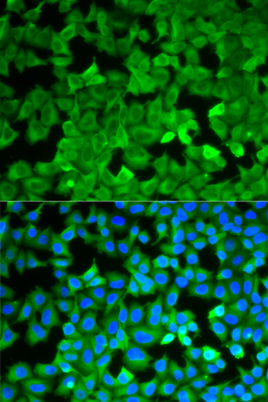 Immunofluorescence analysis of A549 cells using ASNS antibody (19-731) . Blue: DAPI for nuclear staining.