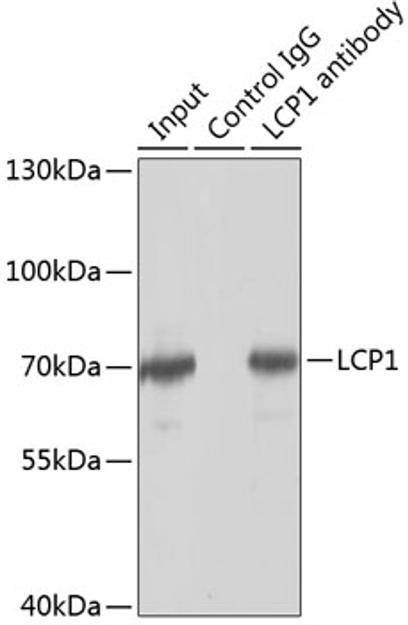 Immunoprecipitation analysis of 150ug extracts of Jurkat cells using 3ug LCP1 antibody (19-733) . Western blot was performed from the immunoprecipitate using LCP1 antibody (19-733) at a dilition of 1:1000.