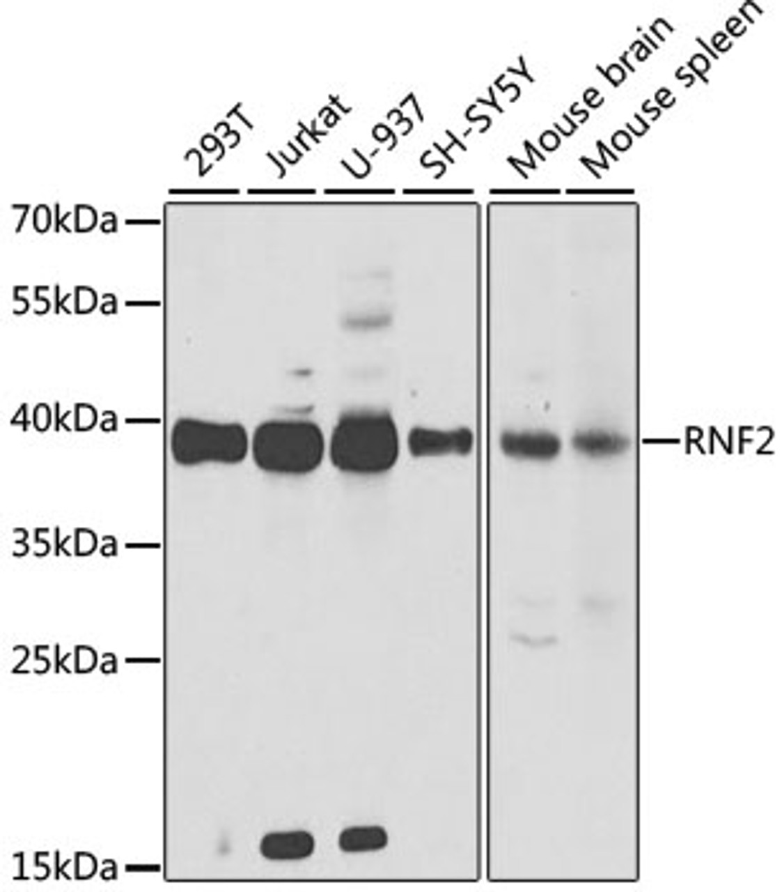 Western blot analysis of extracts of various cell lines, using RNF2 antibody (19-735) at 1:1000 dilution.<br/>Secondary antibody: HRP Goat Anti-Rabbit IgG (H+L) at 1:10000 dilution.<br/>Lysates/proteins: 25ug per lane.<br/>Blocking buffer: 3% nonfat dry milk in TBST.<br/>Detection: ECL Basic Kit.<br/>Exposure time: 90s.