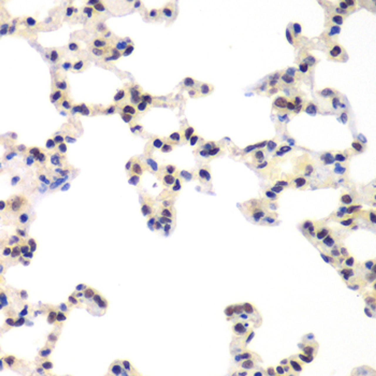 Immunohistochemistry of paraffin-embedded rat lung using RNF2 antibody (19-735) at dilution of 1:100 (40x lens) .