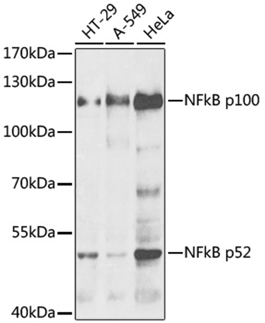 Western blot analysis of extracts of various cell lines, using NFkB p100 / p52 antibody (19-737) .<br/>Secondary antibody: HRP Goat Anti-Rabbit IgG (H+L) at 1:10000 dilution.<br/>Lysates/proteins: 25ug per lane.<br/>Blocking buffer: 3% nonfat dry milk in TBST.