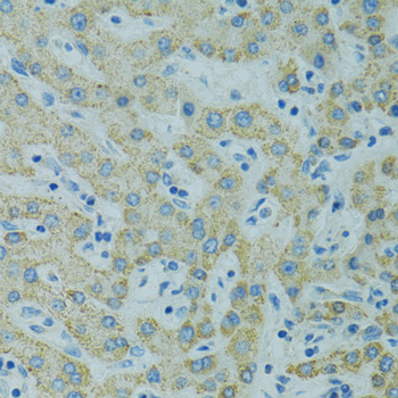 Immunohistochemistry of paraffin-embedded human liver using STX1A antibody (19-739) at dilution of 1:100 (40x lens) .