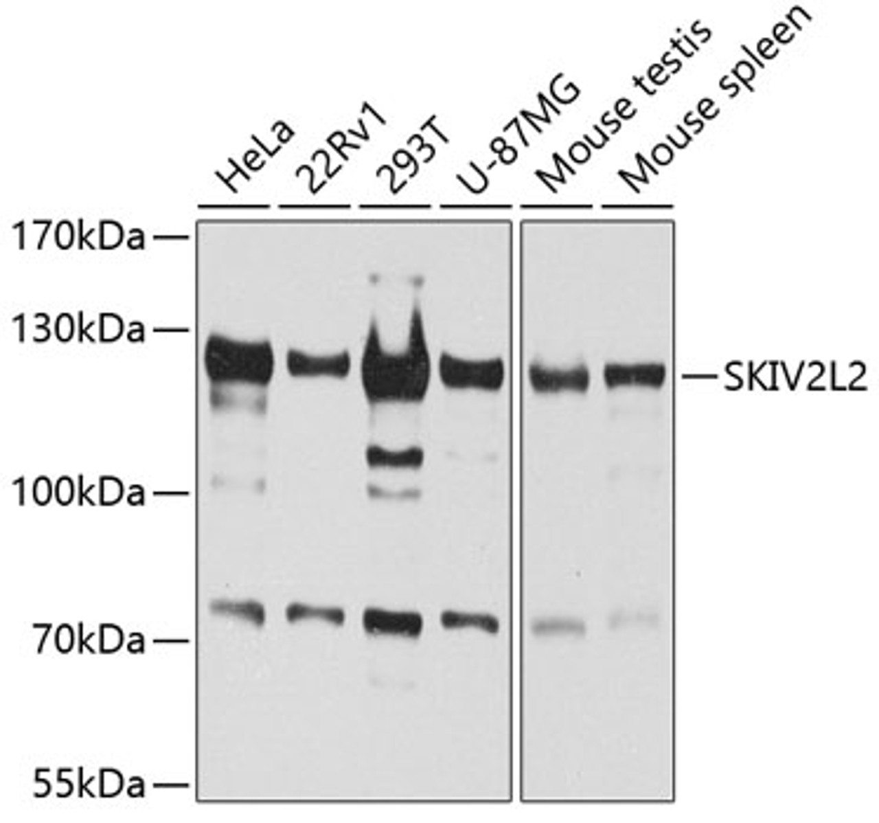 Western blot analysis of extracts of various cell lines, using SKIV2L2 antibody (19-742) at 1:1000 dilution.<br/>Secondary antibody: HRP Goat Anti-Rabbit IgG (H+L) at 1:10000 dilution.<br/>Lysates/proteins: 25ug per lane.<br/>Blocking buffer: 3% nonfat dry milk in TBST.<br/>Detection: ECL Basic Kit.<br/>Exposure time: 60s.