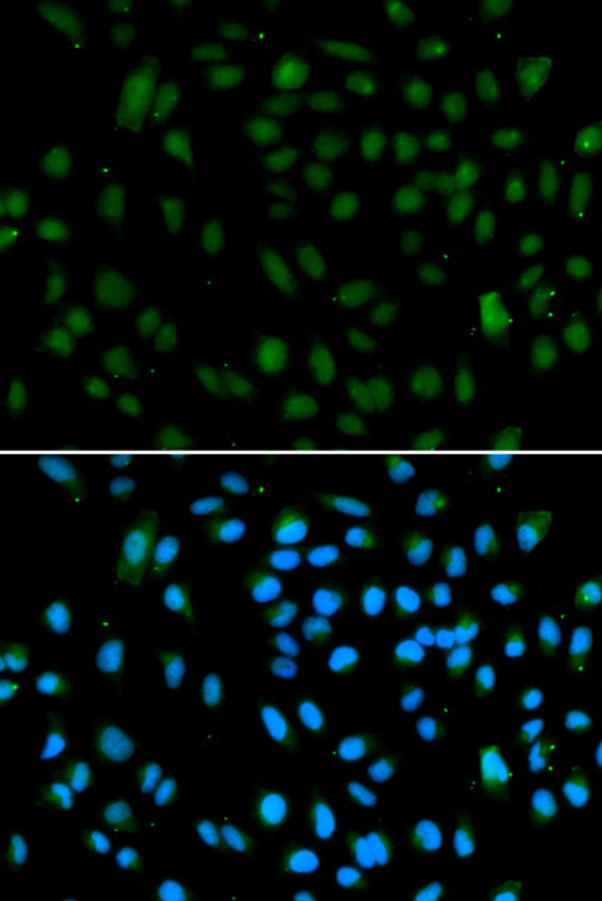 Immunofluorescence analysis of A549 cells using WHSC1L1 antibody (19-743) . Blue: DAPI for nuclear staining.