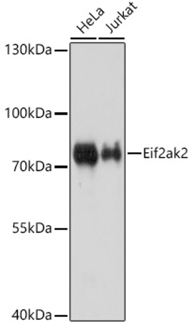 Western blot analysis of extracts of various cell lines, using Eif2ak2 antibody (19-744) at 1:1000 dilution.<br/>Secondary antibody: HRP Goat Anti-Rabbit IgG (H+L) at 1:10000 dilution.<br/>Lysates/proteins: 25ug per lane.<br/>Blocking buffer: 3% nonfat dry milk in TBST.<br/>Detection: ECL Basic Kit.<br/>Exposure time: 1s.
