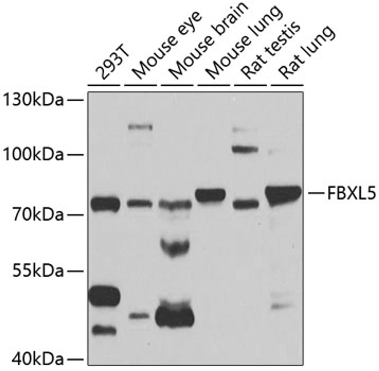 Western blot analysis of extracts of various cell lines, using FBXL5 antibody (19-751) at 1:1000 dilution.<br/>Secondary antibody: HRP Goat Anti-Rabbit IgG (H+L) at 1:10000 dilution.<br/>Lysates/proteins: 25ug per lane.<br/>Blocking buffer: 3% nonfat dry milk in TBST.<br/>Detection: ECL Basic Kit.<br/>Exposure time: 10s.
