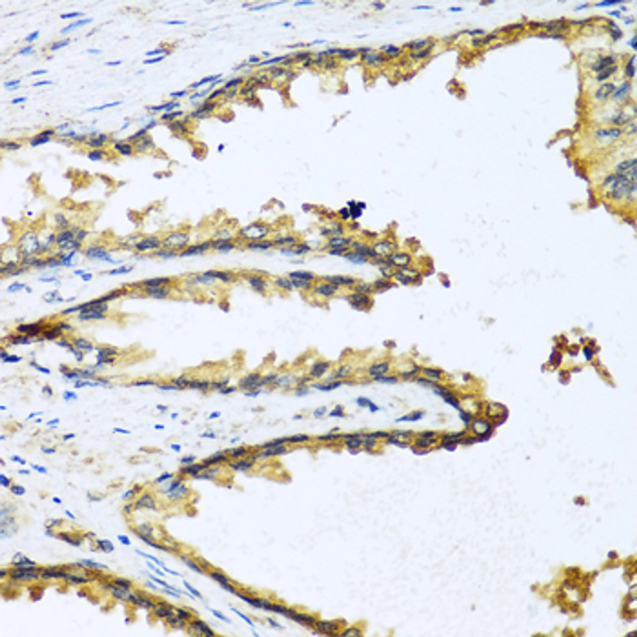 Immunohistochemistry of paraffin-embedded human prostate using GNRH1 antibody (19-763) at dilution of 1:100 (40x lens) .