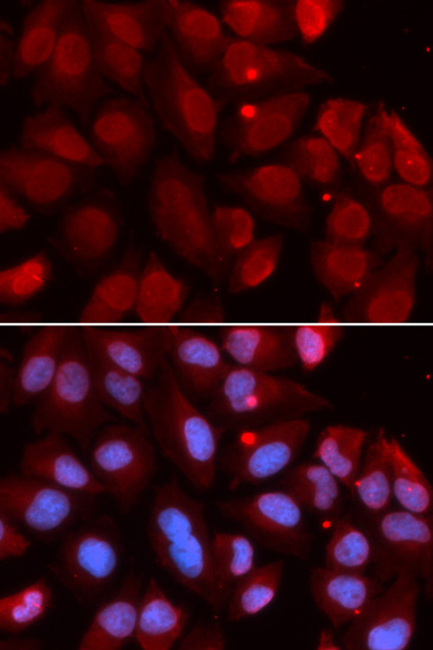 Immunofluorescence analysis of U2OS cells using RAG2 antibody (19-764) . Blue: DAPI for nuclear staining.