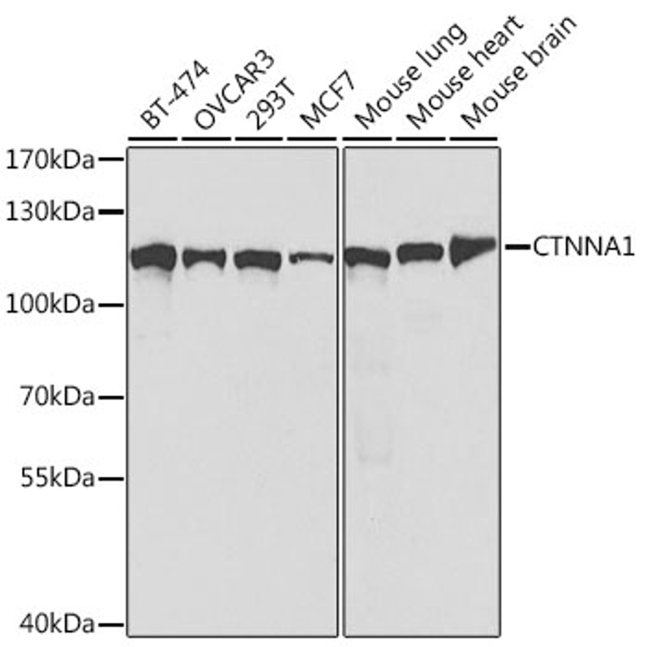 Western blot analysis of extracts of various cell lines, using CTNNA1 antibody (19-768) at 1:1000 dilution.<br/>Secondary antibody: HRP Goat Anti-Rabbit IgG (H+L) at 1:10000 dilution.<br/>Lysates/proteins: 25ug per lane.<br/>Blocking buffer: 3% nonfat dry milk in TBST.<br/>Detection: ECL Basic Kit.<br/>Exposure time: 60s.