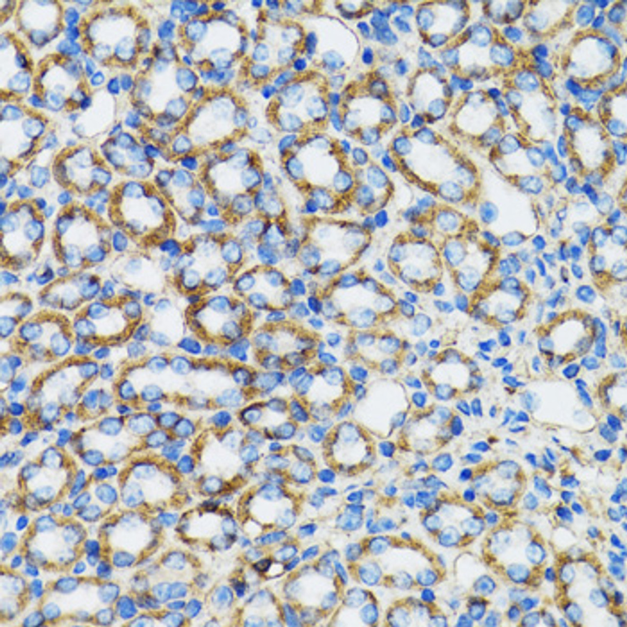 Immunohistochemistry of paraffin-embedded rat kidney using CTNNA1 antibody (19-768) at dilution of 1:100 (40x lens) .