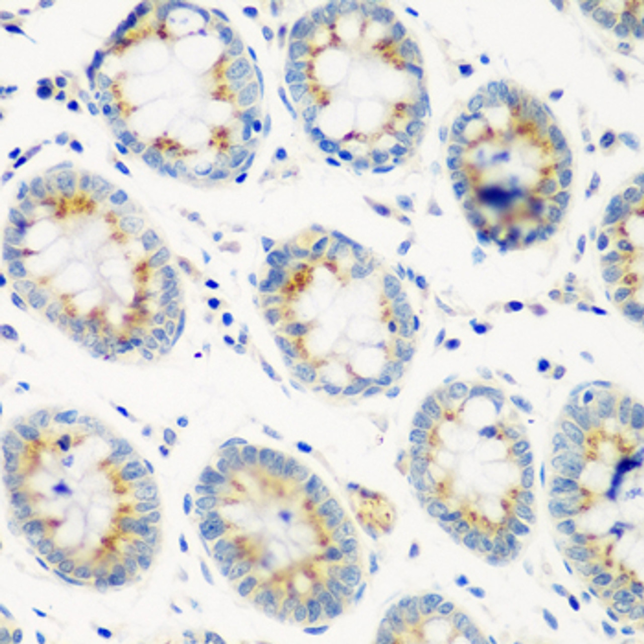 Immunohistochemistry of paraffin-embedded human colon using CTSG antibody (19-769) at dilution of 1:100 (40x lens) .