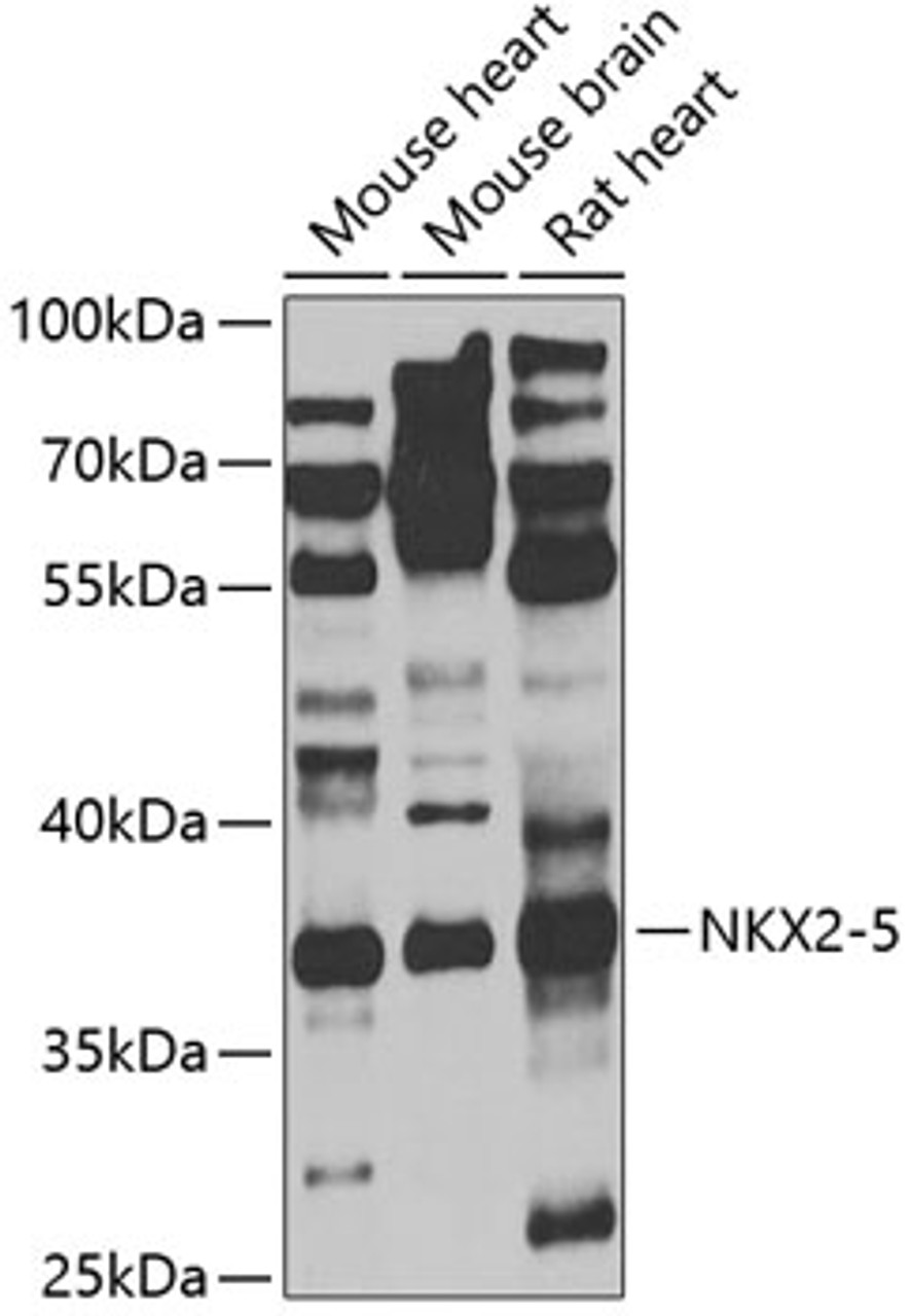 Western blot analysis of extracts of various cell lines, using NKX2-5 antibody (19-777) at 1:1000 dilution._Secondary antibody: HRP Goat Anti-Rabbit IgG (H+L) at 1:10000 dilution._Lysates/proteins: 25ug per lane._Blocking buffer: 3% nonfat dry milk in TBST._Detection: ECL Enhanced Kit._Exposure time: 60s.