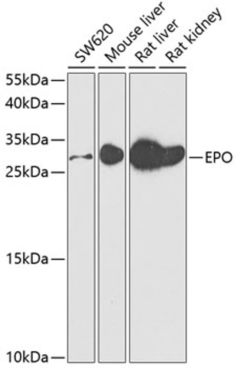 Western blot analysis of extracts of various cell lines, using EPO antibody (19-780) at 1:500 dilution.<br/>Secondary antibody: HRP Goat Anti-Rabbit IgG (H+L) at 1:10000 dilution.<br/>Lysates/proteins: 25ug per lane.<br/>Blocking buffer: 3% nonfat dry milk in TBST.<br/>Detection: ECL Enhanced Kit.<br/>Exposure time: 90s.