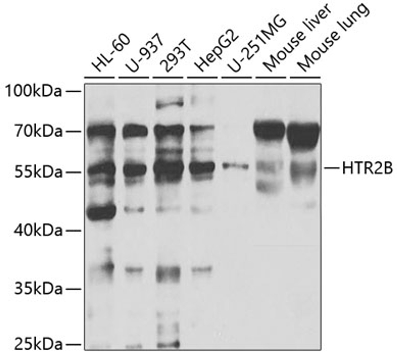 Western blot analysis of extracts of various cell lines, using HTR2B antibody (19-784) at 1:1000 dilution.<br/>Secondary antibody: HRP Goat Anti-Rabbit IgG (H+L) at 1:10000 dilution.<br/>Lysates/proteins: 25ug per lane.<br/>Blocking buffer: 3% nonfat dry milk in TBST.<br/>Detection: ECL Basic Kit.<br/>Exposure time: 30s.