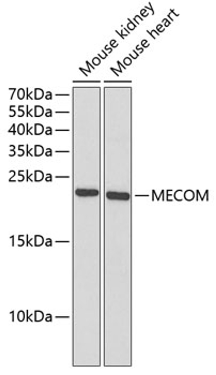 Western blot analysis of extracts of various cell lines, using MECOM antibody (19-785) at 1:1000 dilution.<br/>Secondary antibody: HRP Goat Anti-Rabbit IgG (H+L) at 1:10000 dilution.<br/>Lysates/proteins: 25ug per lane.<br/>Blocking buffer: 3% nonfat dry milk in TBST.<br/>Detection: ECL Basic Kit.<br/>Exposure time: 90s.