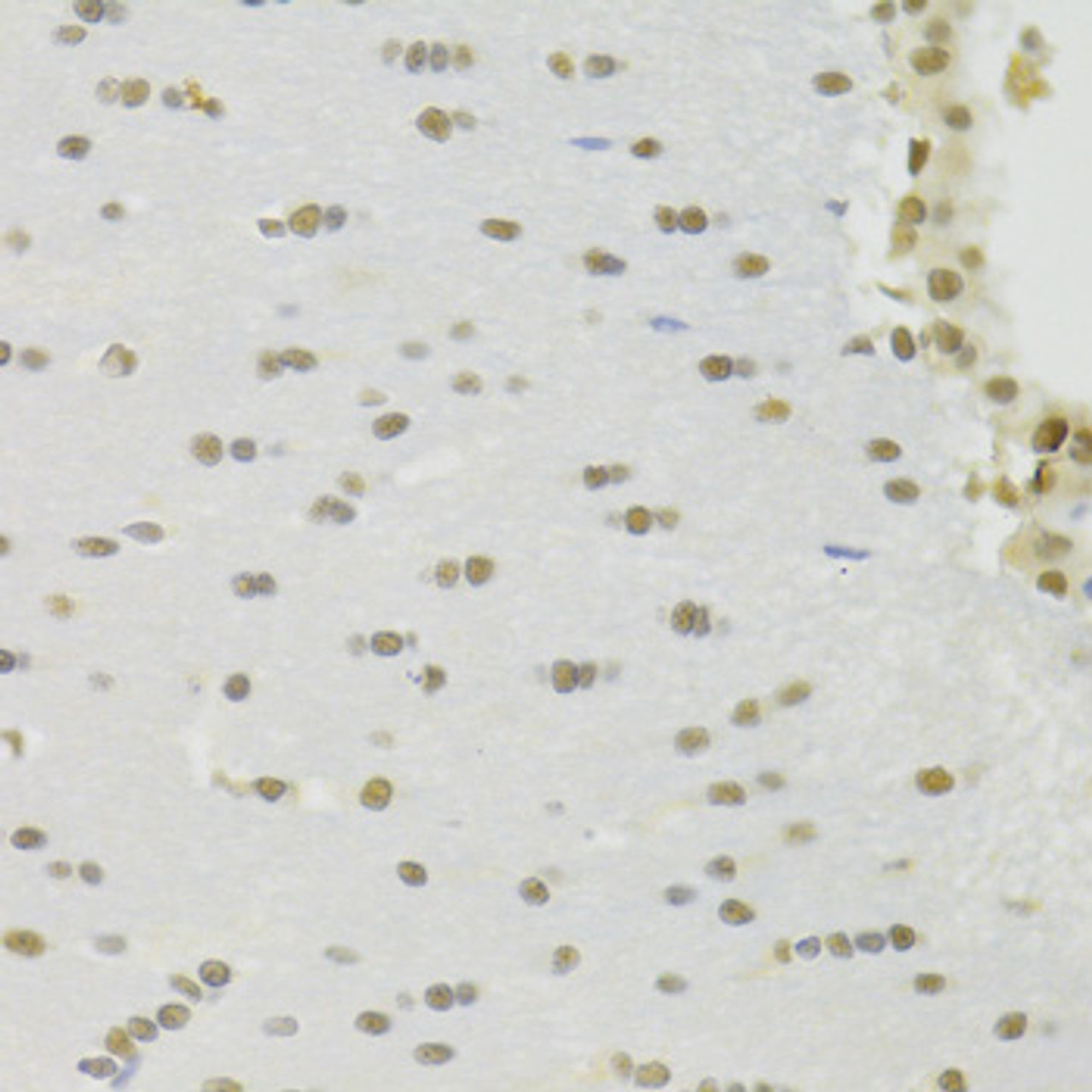 Immunohistochemistry of paraffin-embedded rat brain using RBPJ Antibody (19-786) at dilution of 1:100 (40x lens) .