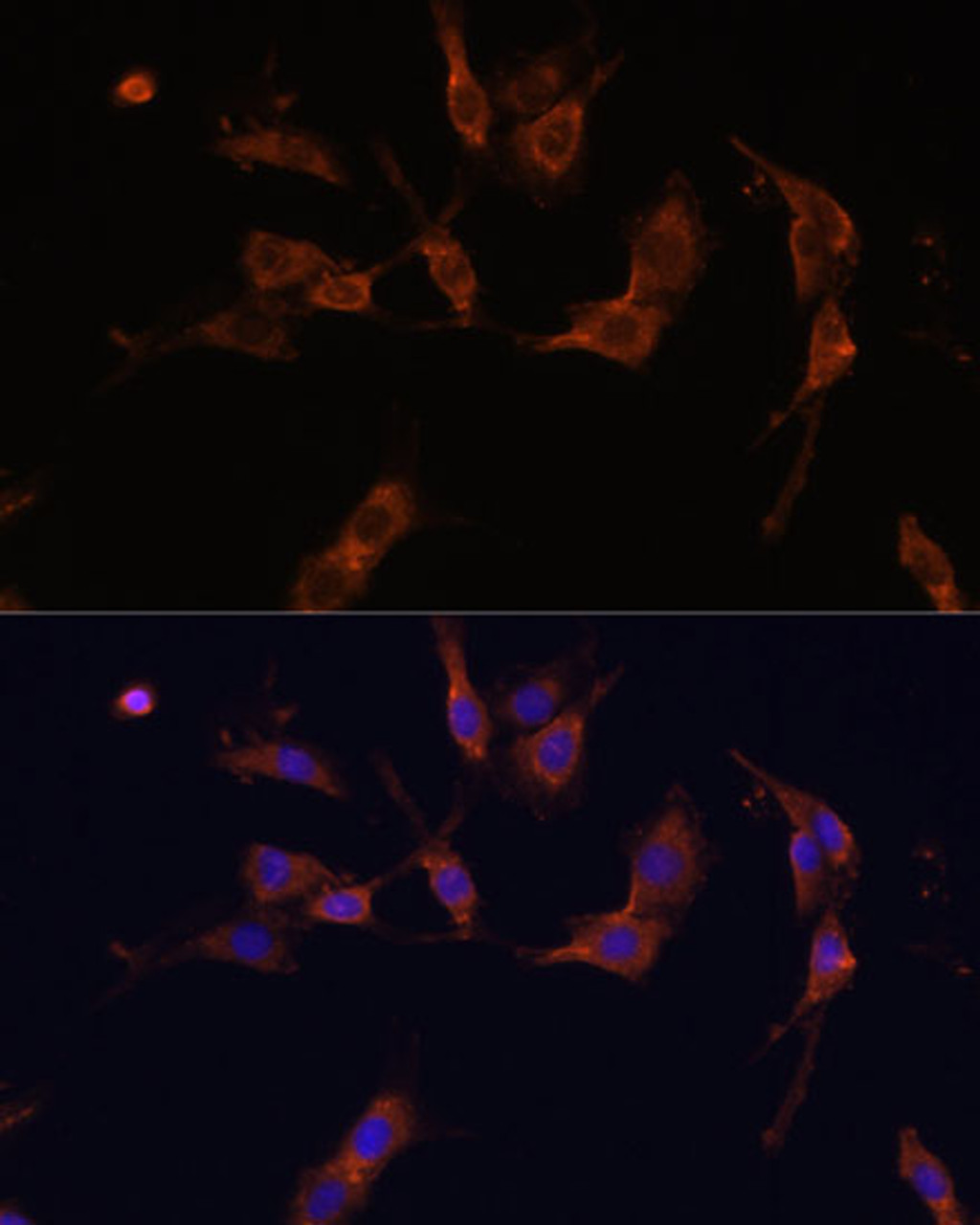 Immunofluorescence analysis of C6 cells using IQGAP1 Polyclonal Antibody (19-788) at dilution of 1:100 (40x lens) . Blue: DAPI for nuclear staining.