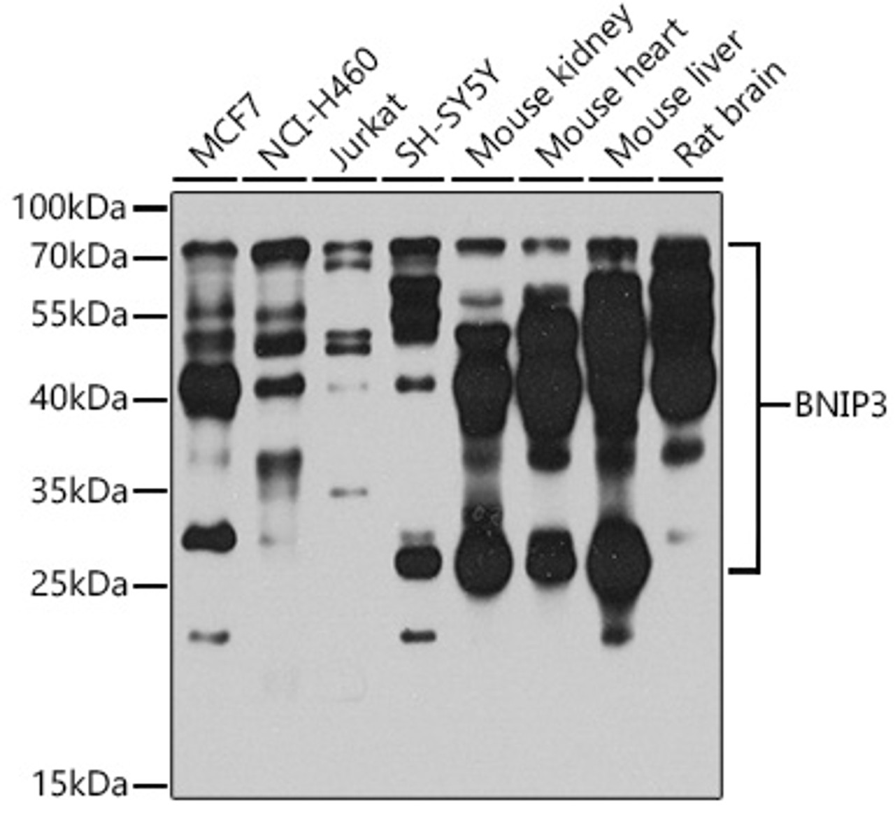 Western blot analysis of extracts of various cell lines, using BNIP3 antibody (19-791) at 1:1000 dilution.<br/>Secondary antibody: HRP Goat Anti-Rabbit IgG (H+L) at 1:10000 dilution.<br/>Lysates/proteins: 25ug per lane.<br/>Blocking buffer: 3% nonfat dry milk in TBST.<br/>Detection: ECL Enhanced Kit.<br/>Exposure time: 30s.