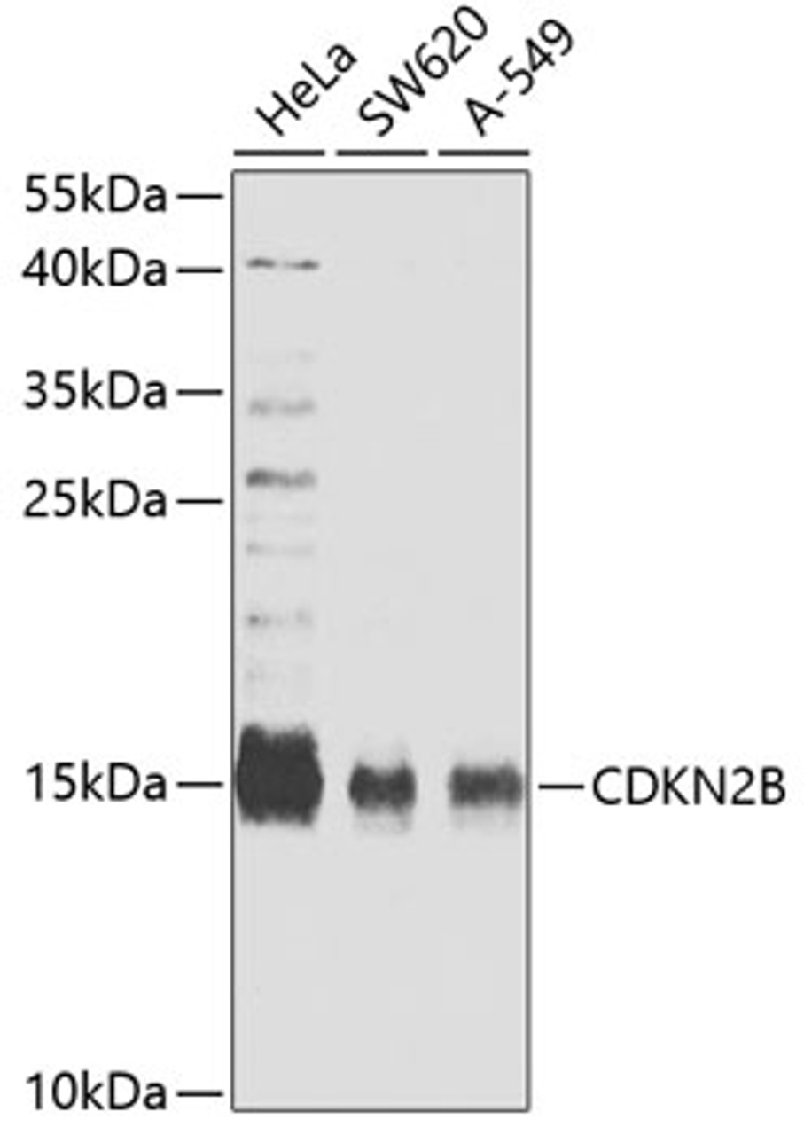 Western blot analysis of extracts of various cell lines, using CDKN2B antibody (19-792) at 1:1000 dilution.<br/>Secondary antibody: HRP Goat Anti-Rabbit IgG (H+L) at 1:10000 dilution.<br/>Lysates/proteins: 25ug per lane.<br/>Blocking buffer: 3% nonfat dry milk in TBST.<br/>Detection: ECL Enhanced Kit.<br/>Exposure time: 90s.