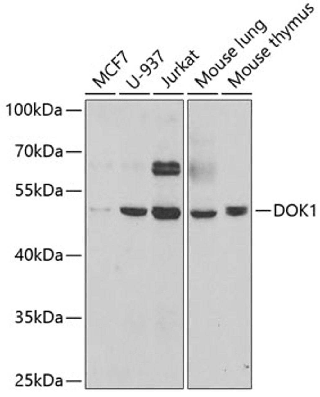 Western blot analysis of extracts of various cell lines, using DOK1 antibody (19-794) at 1:1000 dilution.<br/>Secondary antibody: HRP Goat Anti-Rabbit IgG (H+L) at 1:10000 dilution.<br/>Lysates/proteins: 25ug per lane.<br/>Blocking buffer: 3% nonfat dry milk in TBST.<br/>Detection: ECL Basic Kit.<br/>Exposure time: 90s.