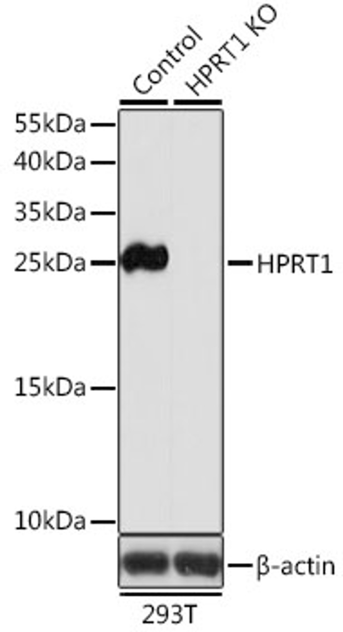 Western blot analysis of extracts from normal (control) and HPRT1 knockout (KO) 293T cells, using HPRT1 antibody (19-798) at 1:1000 dilution.<br/>Secondary antibody: HRP Goat Anti-Rabbit IgG (H+L) at 1:10000 dilution.<br/>Lysates/proteins: 25ug per lane.<br/>Blocking buffer: 3% nonfat dry milk in TBST.<br/>Detection: ECL Basic Kit.<br/>Exposure time: 5s.