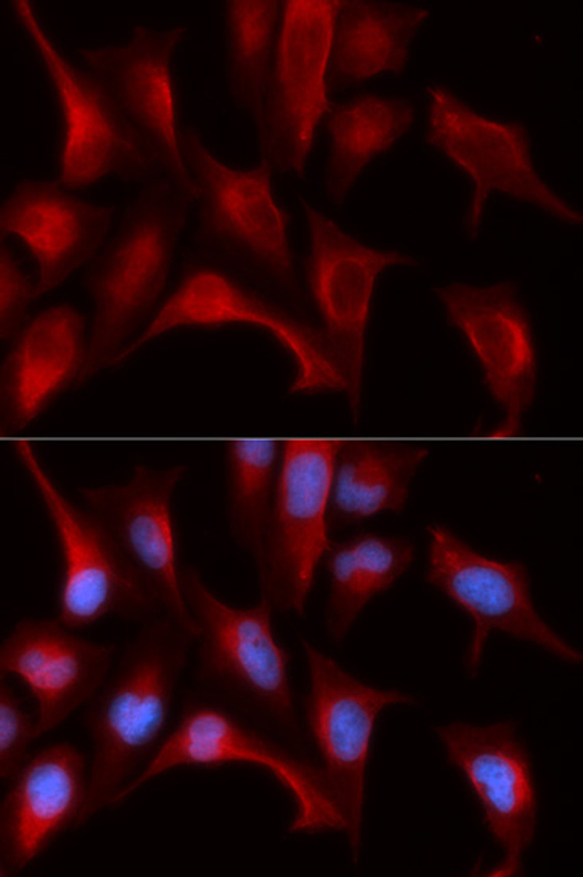 Immunofluorescence analysis of U2OS cells using PSMB4 antibody (19-802) . Blue: DAPI for nuclear staining.