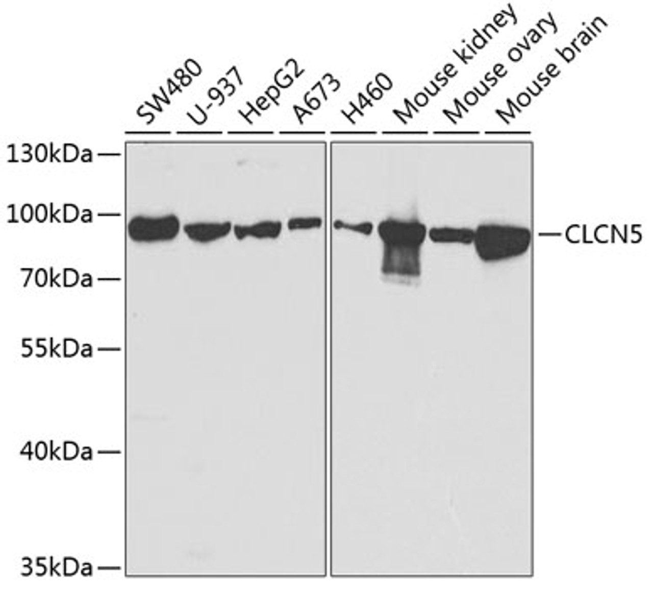 Western blot analysis of extracts of various cell lines, using CLCN5 antibody (19-806) at 1:1000 dilution.<br/>Secondary antibody: HRP Goat Anti-Rabbit IgG (H+L) at 1:10000 dilution.<br/>Lysates/proteins: 25ug per lane.<br/>Blocking buffer: 3% nonfat dry milk in TBST.<br/>Detection: ECL Basic Kit.<br/>Exposure time: 90s.