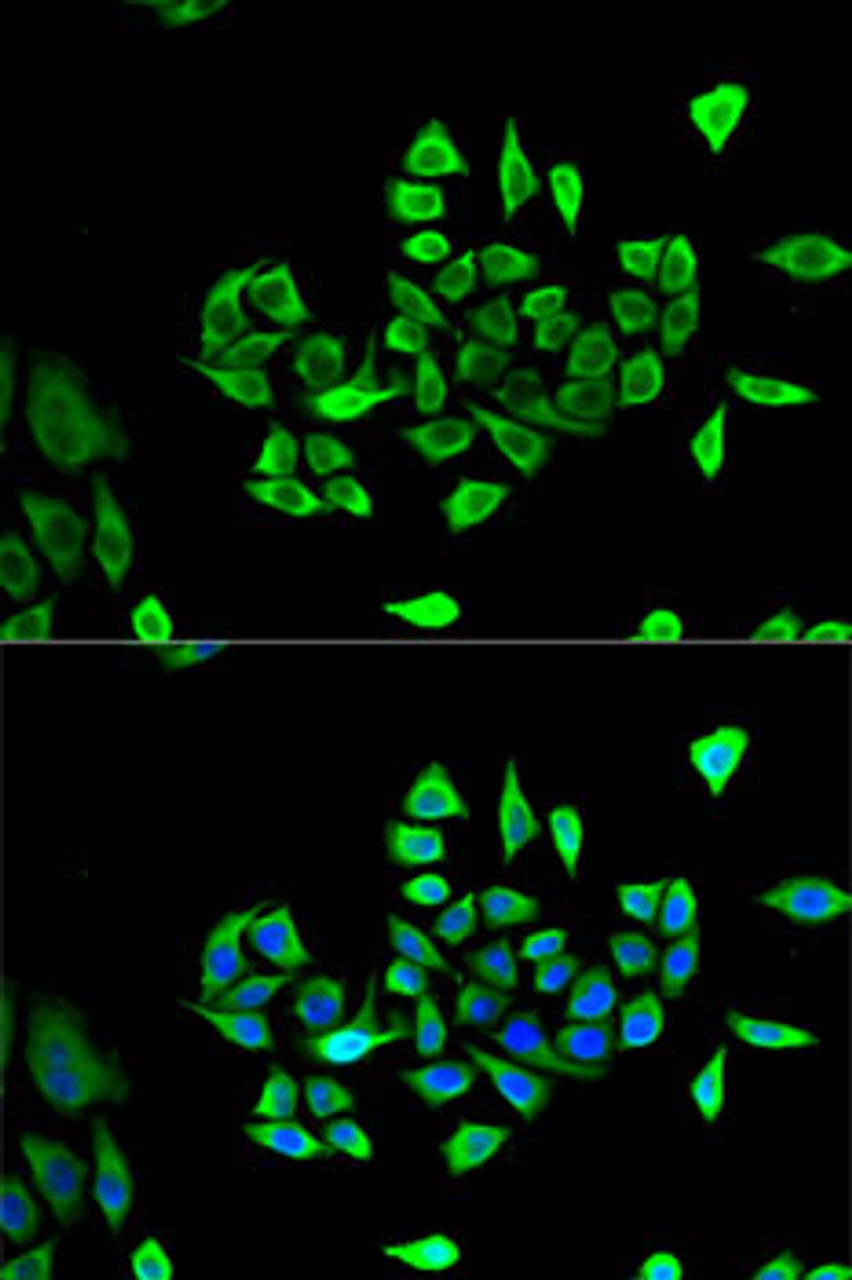 Immunofluorescence analysis of U2OS cells using CLCN5 antibody (19-806) . Blue: DAPI for nuclear staining.