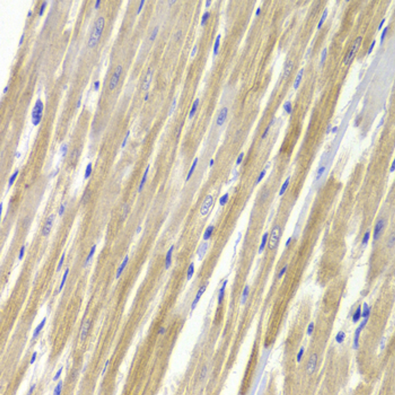 Immunohistochemistry of paraffin-embedded rat heart using GPD1 Antibody (19-810) at dilution of 1:100 (40x lens) .