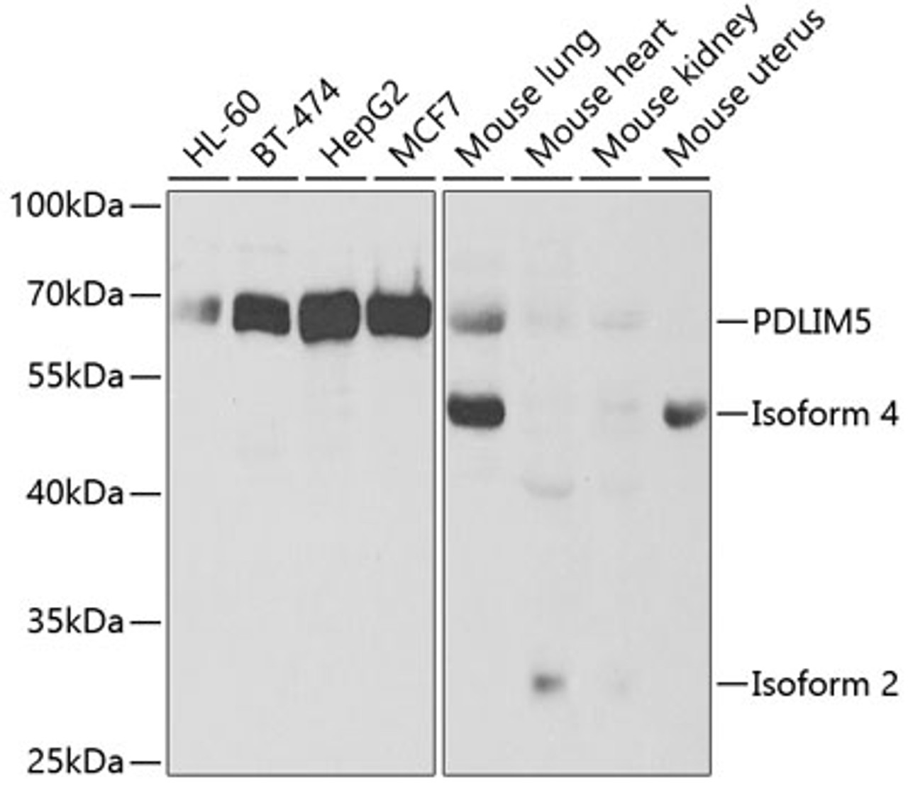 Western blot analysis of extracts of various cell lines, using PDLIM5 antibody (19-814) at 1:1000 dilution.<br/>Secondary antibody: HRP Goat Anti-Rabbit IgG (H+L) at 1:10000 dilution.<br/>Lysates/proteins: 25ug per lane.<br/>Blocking buffer: 3% nonfat dry milk in TBST.