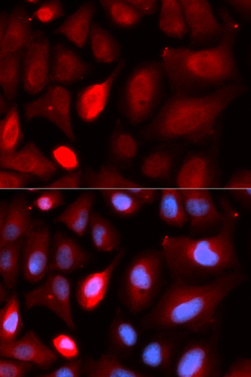 Immunofluorescence analysis of U2OS cells using PDLIM5 antibody (19-814) . Blue: DAPI for nuclear staining.