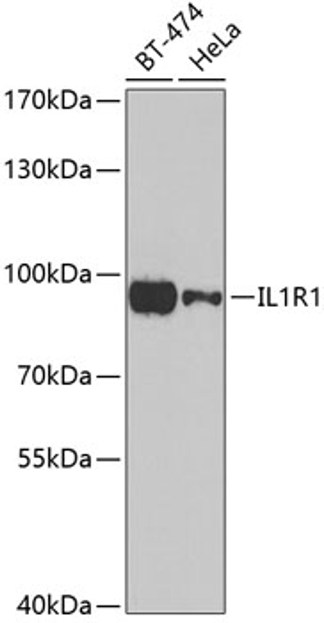 Western blot analysis of extracts of various cell lines, using IL1R1 antibody (19-818) at 1:1000 dilution.<br/>Secondary antibody: HRP Goat Anti-Rabbit IgG (H+L) at 1:10000 dilution.<br/>Lysates/proteins: 25ug per lane.<br/>Blocking buffer: 3% nonfat dry milk in TBST.<br/>Detection: ECL Basic Kit.<br/>Exposure time: 90s.