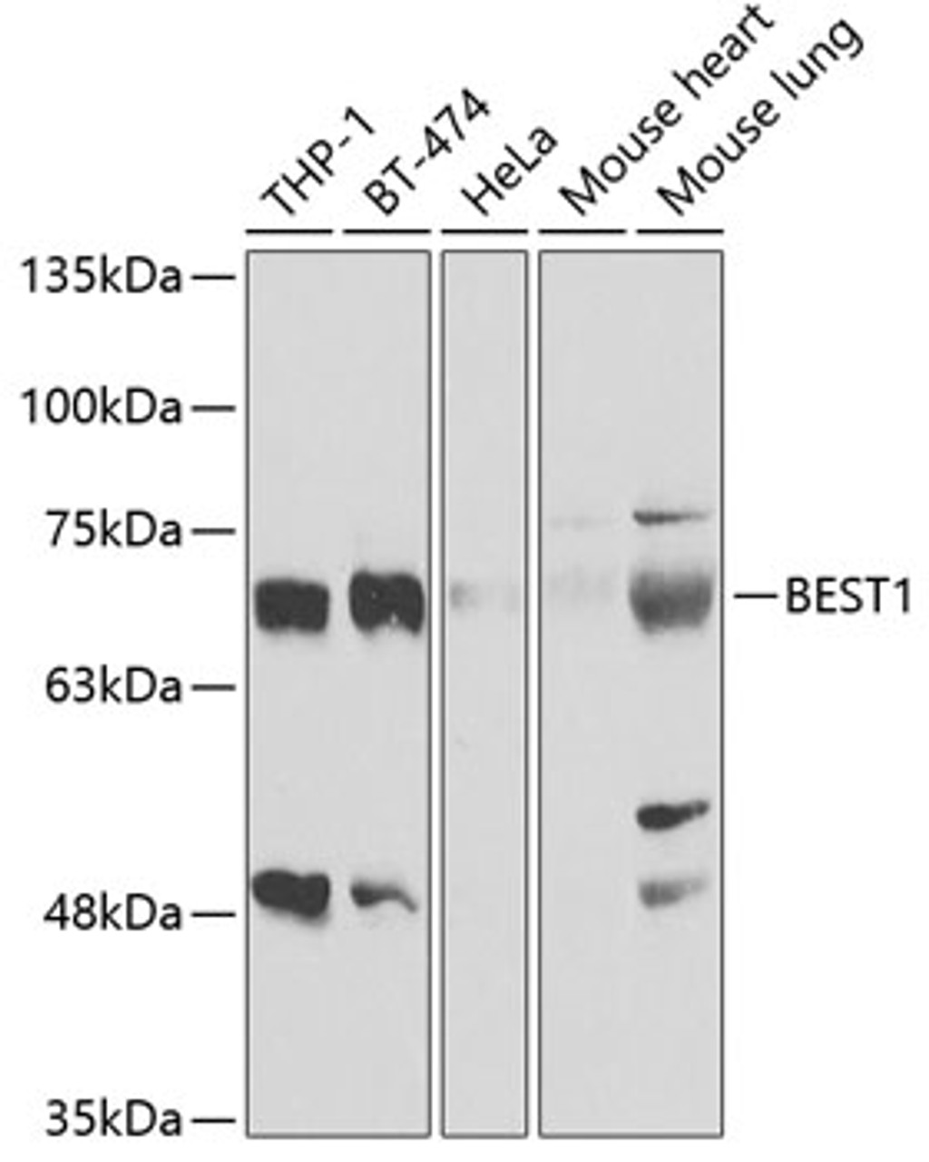 Western blot analysis of extracts of various cell lines, using BEST1 antibody (19-824) at 1:1000 dilution.<br/>Secondary antibody: HRP Goat Anti-Rabbit IgG (H+L) at 1:10000 dilution.<br/>Lysates/proteins: 25ug per lane.<br/>Blocking buffer: 3% nonfat dry milk in TBST.