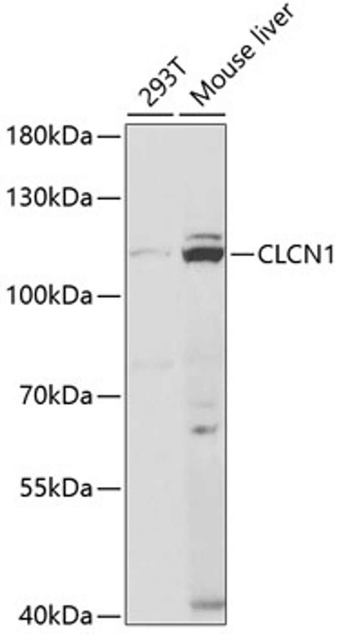 Western blot analysis of extracts of various cell lines, using CLCN1 antibody (19-827) at 1:1000 dilution.<br/>Secondary antibody: HRP Goat Anti-Rabbit IgG (H+L) at 1:10000 dilution.<br/>Lysates/proteins: 25ug per lane.<br/>Blocking buffer: 3% nonfat dry milk in TBST.<br/>Detection: ECL Basic Kit.<br/>Exposure time: 90s.