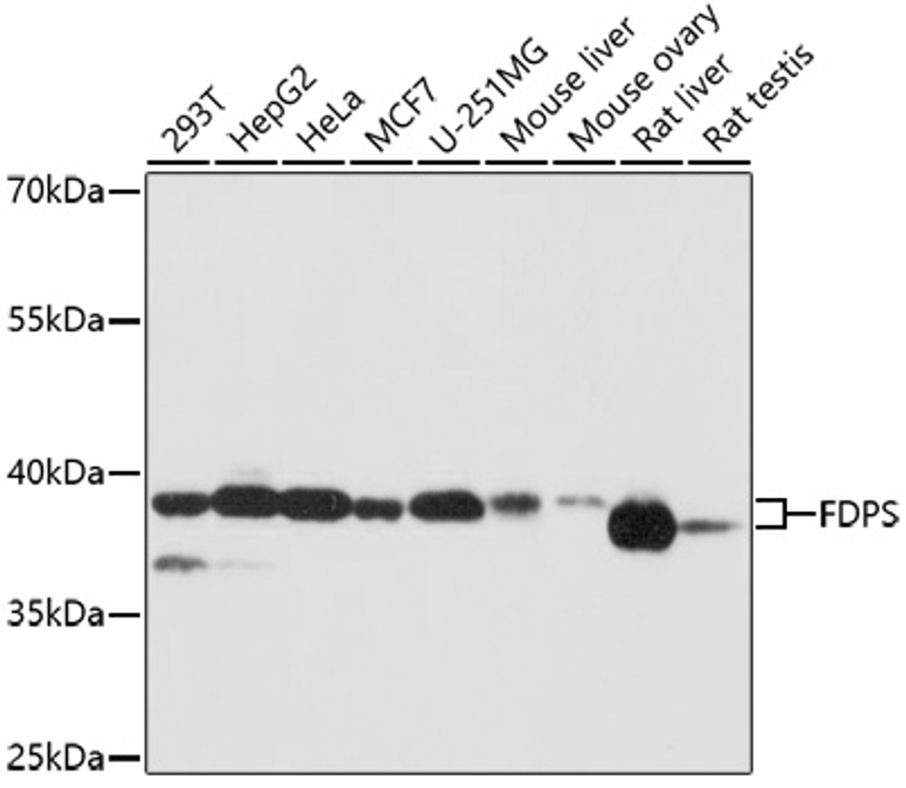 Immunohistochemistry of paraffin-embedded rat brain using FDPS Antibody (19-830) at dilution of 1:100 (40x lens) .